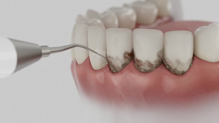 Reliable Dental Implants contractor in Hallam, PA by Smile Center Dentistry